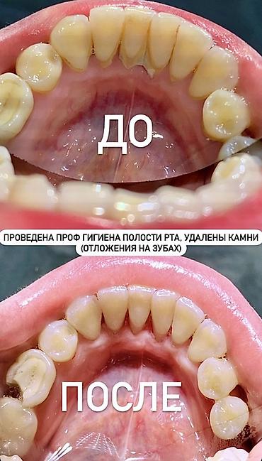 Красота и здоровье: Профессиональная гигиена полости рта (чистка зубов) Что входит: - — 9