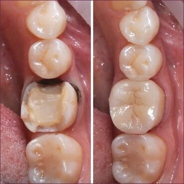 стоматологические кресла цена: Стоматолог | Реставрация, Протезирование, Чистка зубов | Консультация