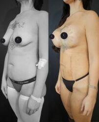 Digər gözəllik və estetika cihazları: Plastik estetik hər yüksək səviyyə uyğun qiymət!!!Burdan mesaj — 10