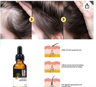 Уход за телом: США средство от облысения от выпадения волос для роста волос будит — 14