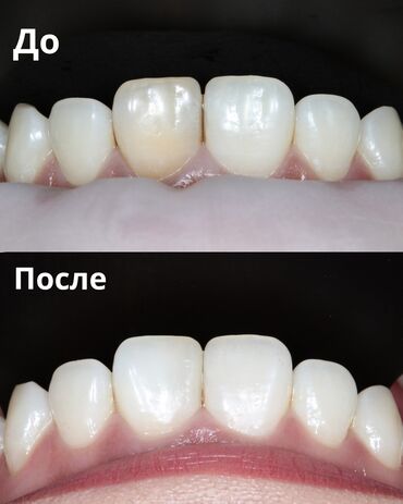 наркология бишкек выезд на дом: Эстетическая и терапевтическая стоматология Услуги: - Художественная