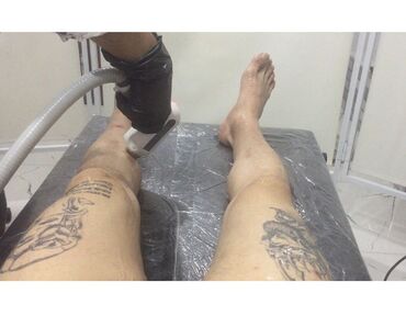 Kosmetologiya: Bəylər üçün = Lazer Epilasiyasi✅Hicama və — 11