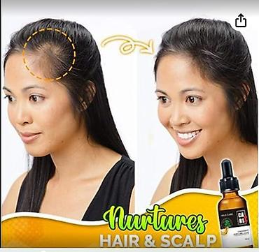 Уход за телом: США средство от облысения от выпадения волос для роста волос будит — 6