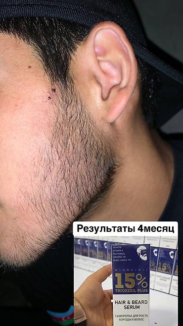 Уход за телом: Рост борода и волосы Миноксидил ультра 15% оригинал✅из Турции🇹🇷 — 6