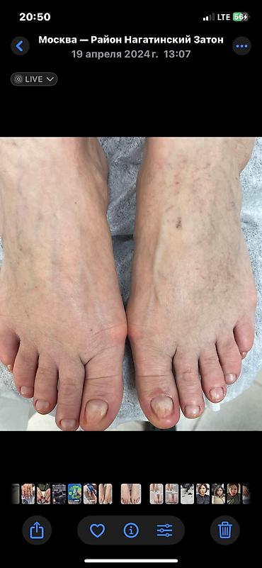 Маникюр, педикюр: Коррекция вросших ногтей, Услуги подолога, С выездом на дом, Консультация, Одноразовые расходные материалы — 2