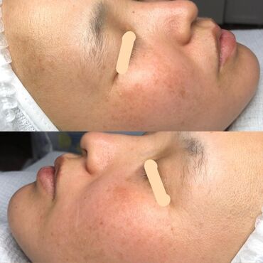 Косметология: Косметология, Чистка кожи, Биоревитализация, Пилинг, Сертифицированный косметолог, Гипоаллергенные материалы, Консультация — 4