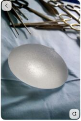 Digər gözəllik və estetika cihazları: Plastik estetik hər yüksək səviyyə uyğun qiymət!!!Burdan mesaj — 9