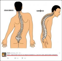 Бандажи, корсеты, корректоры: Корсеты, корректоры осанки, пояса для спины, реклинаторы 9-11 — 2