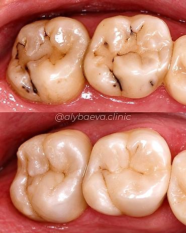 Сулуулук жана ден-соолук: Стоматология Dr. Alybaeva dental clinic Услуги: - Лечение без боли - — 7