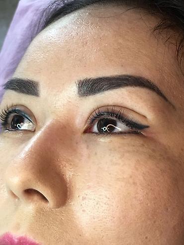 Косметология: Косметология, Ботокс, Биоревитализация, Ботулинотерапия, Консультация, Гипоаллергенные материалы, Сертифицированный косметолог — 10