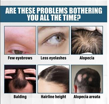 Уход за телом: США против выпадения волос ouhoe от облысения восстанавливающий спрей — 7