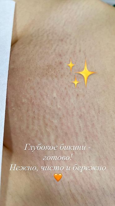 массаж женщины: Качественный бережный Шугаринг тела. Только для женщин . Цены на — 4
