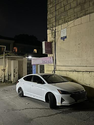 qosqu satisi: Barter de var nivada olsa olar 13 ay 540 azn qalib 17000 deyerinde — 2