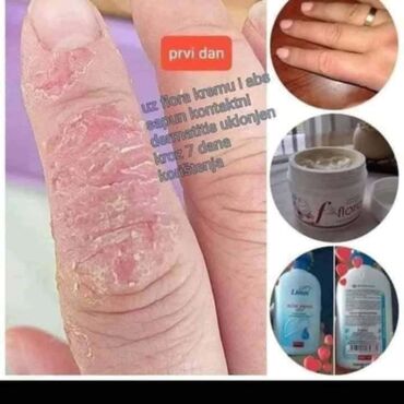 balenciaga patike triple s: Isustvo nasih korisnika sa psorijazom 🍀Probajte i vi nase peoizvode na