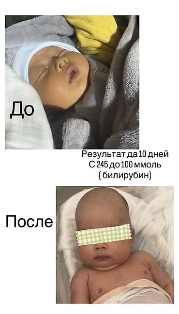 лет лампа: Фототерапевтическая лампа для лечения физиологической желтухи Для — 2