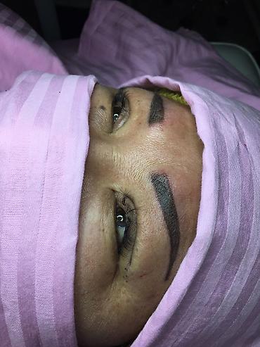 Косметология: Косметология, Ботокс, Биоревитализация, Ботулинотерапия, Консультация, Гипоаллергенные материалы, Сертифицированный косметолог — 6