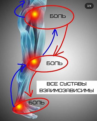 артапический обувь: Алтын батек адамдын болгон 207 соогун туздоп 1_артрит,моноартрит — 6