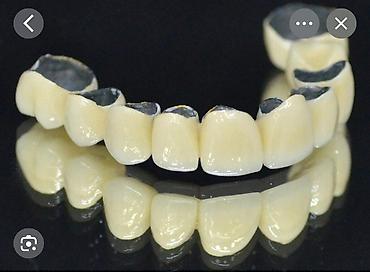 Услуги: Metal ve keramika alıram ağza girib çıxmiş olmalıdır mütleq 100 qr 15 — 1