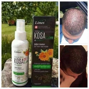 Nega kose: KosaLim 💚 Kosalim je kombinacija prirodnih ekstrakta lekovitog bilja na lalafo.rs — 7 Nega kose: KosaLim 💚 Kosalim je kombinacija prirodnih ekstrakta lekovitog bilja — 7