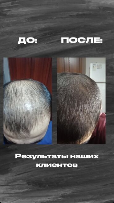 Косметика: Средство для роста волос и бороды - Назначение: усиление роста щетины — 3