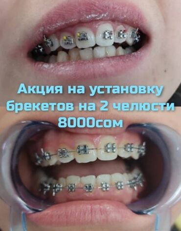 виниловые пластинки бишкек in Кыргызстан | КНИГИ, ЖУРНАЛЫ, CD, DVD: Стоматолог | Брекет системы, пластинки | Консультация, Круглосуточно