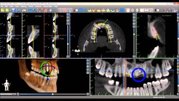 Stomatologiya: Diş texnikleri için ve doktorlar için gerekli programlar. Detaylı