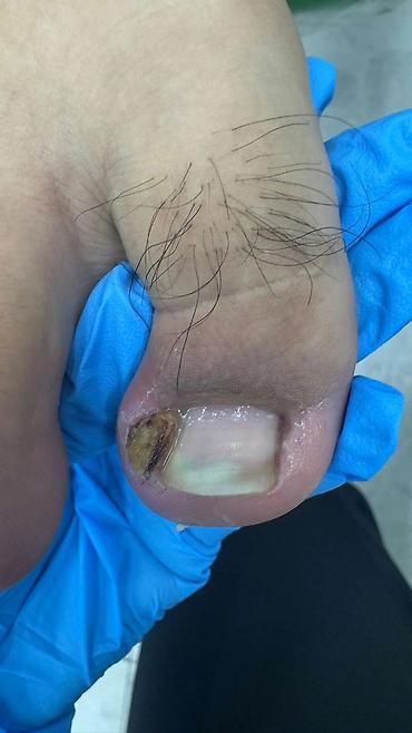 Маникюр: Коррекция вросших ногтей, Маникюр, Педикюр, Услуги подолога, С выездом на дом, Консультация, Одноразовые расходные материалы — 21