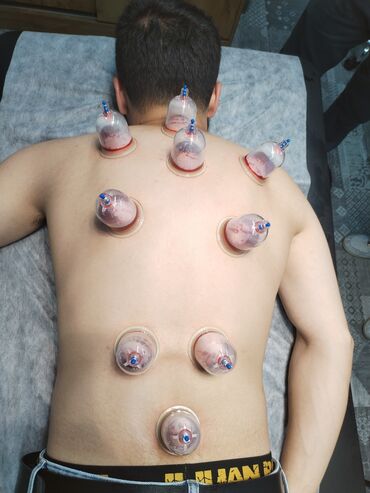 Hicama, zəli: İlk önce masaj hicama, zeli üzre bir mütexessis kimi onu deye bilerem — 8