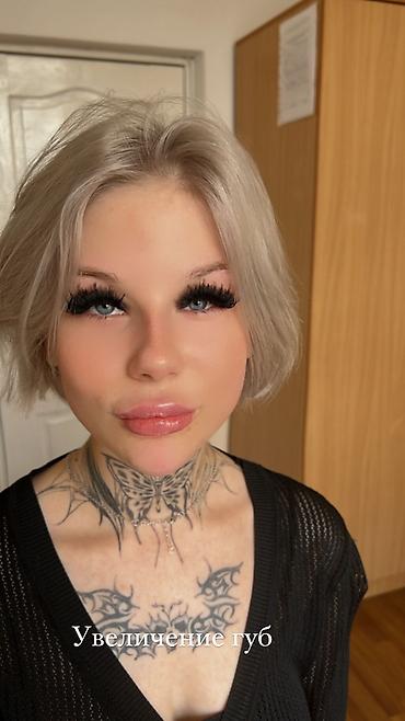 Косметология: Косметология, Ботокс, Биоревитализация, Ботулинотерапия, Консультация, Гипоаллергенные материалы, Сертифицированный косметолог at lalafo.kg — 11 Косметология: Косметология, Ботокс, Биоревитализация, Ботулинотерапия, Консультация, Гипоаллергенные материалы, Сертифицированный косметолог — 11