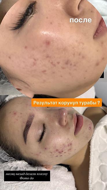 Красота и здоровье: МУЖСКАЯ И ЖЕНСКАЯ ПРОФЕССИОНАЛЬНАЯ ЧИСТКА Лица 1900сом 14 этапная — 5