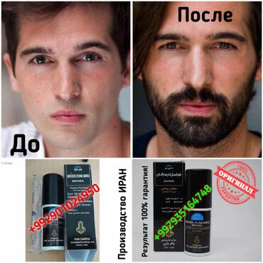 Косметика: Миноксидил иранский minoxidil iran ️️️производство иран ️️️срок