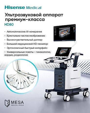 hissense: Hisense Medical USM cihazları – portativ və premium sinif ultrasəs — 2
