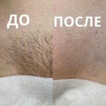Шугаринг подмышек Мастер с опытом работы принимаю на дому