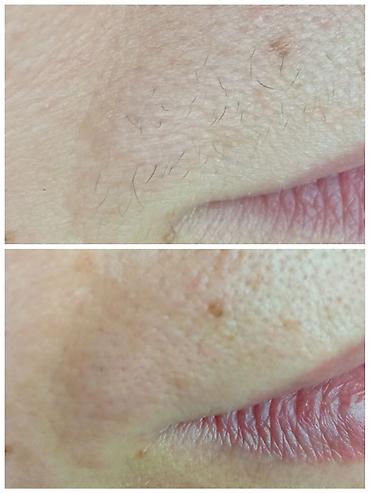 Другие услуги в сфере красоты и здоровья: Тридинг лица Тридинг — 10