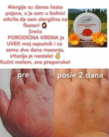 Nega kože: Limes Rosa Porodična krema – kantarion i neven Višenamenska krema za — 2