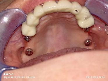 Медицинские услуги: Клиника | Стоматолог | Протезирование — 7