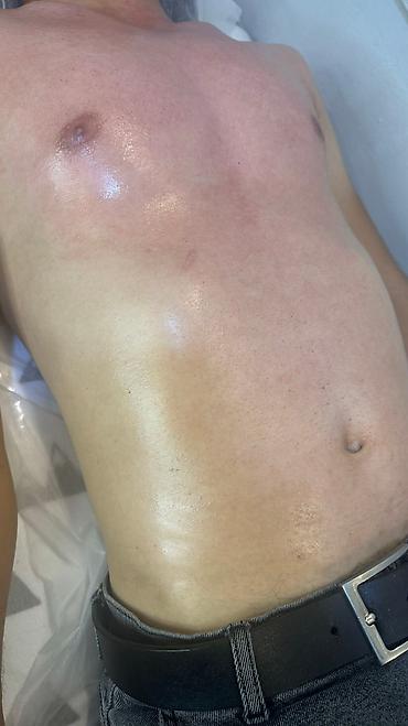 Эпиляция: Мужской шугаринг. Восковая депиляция — 12