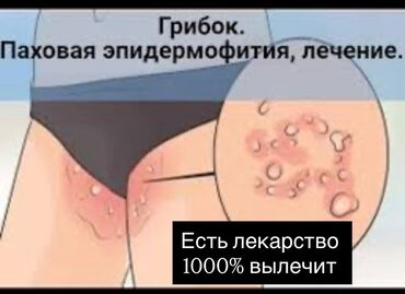 национальный костюм на прокат: Не принимать ‼️ Текназол убивает печень и дорого не помогает