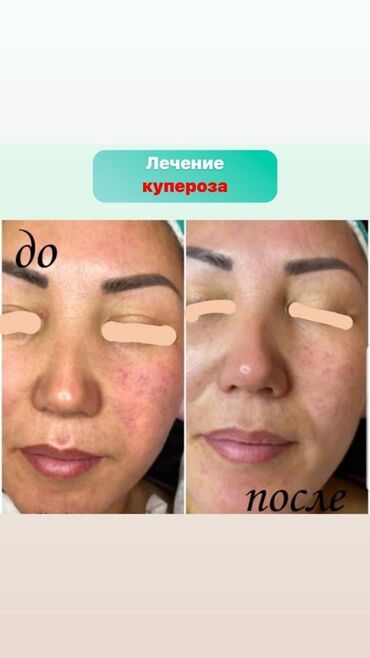 Косметология: Косметология, Чистка кожи, Биоревитализация, Пилинг, Сертифицированный косметолог, Гипоаллергенные материалы, Консультация — 6