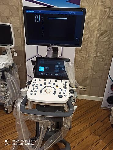 Tibbi avadanlıq: USM ( Uzi) cihazlarin 30% ilkin idenisle bütün nov USM ( Uzi) — 7
