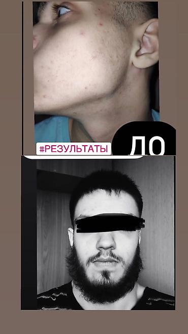 Уход за телом: Рост борода и волосы Миноксидил ультра 15% оригинал✅из Турции🇹🇷 — 2