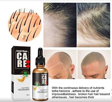 Уход за телом: США средство от облысения от выпадения волос для роста волос будит — 4