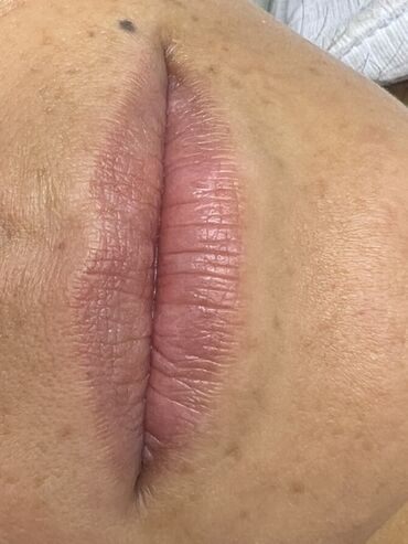 Косметология: Косметология, Маски, Мезотерапия, Удаление носогубных складок, Гипоаллергенные материалы, Консультация, Сертифицированный косметолог — 60