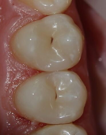 Stomatologiya: Stomatoloq Dr. Feyruz Dadaşovun fərdi praktikadasında böyüklərin və — 8
