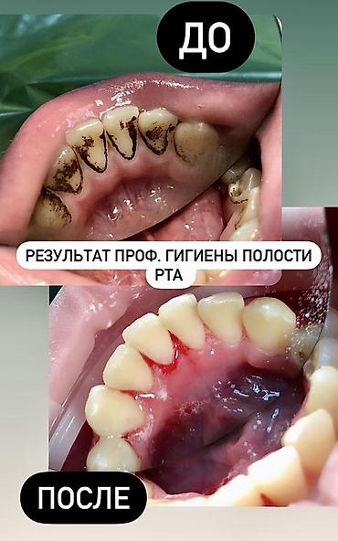Красота и здоровье: Профессиональная гигиена полости рта (чистка зубов) Что входит: - — 7
