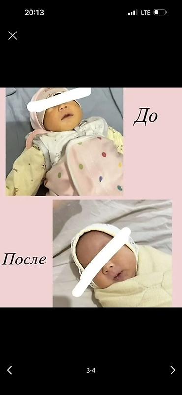 товары для инвалидов: Фототерапевтическая лампа для лечения неонатальной желтухи (домашнего — 3