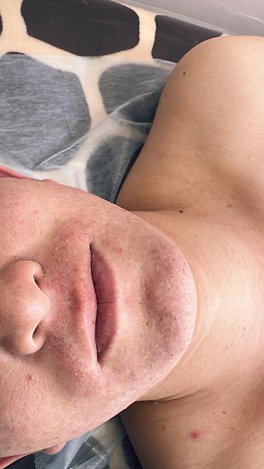 Эпиляция: Мужской шугаринг. Восковая депиляция — 4