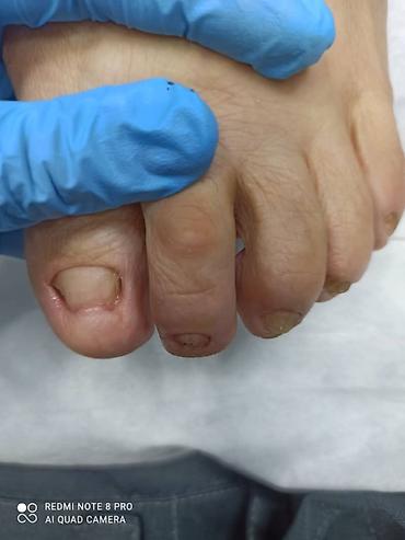 Маникюр: Ремонт сломаных ногтей, Наращивание ногтей, Донаращивание ногтей, Услуги подолога, Маникюр, Педикюр, Консультация, Одноразовые расходные материалы — 2