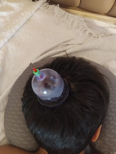 Hicama, zəli: Hicama, quru və yaş vakuum masajı, həmçinin zəli ilə müalicə xidməti — 5