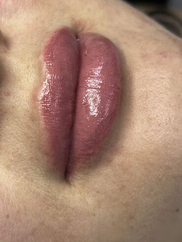 Косметология: Косметология, Ботокс, Биоревитализация, Ботулинотерапия, Консультация, Гипоаллергенные материалы, Сертифицированный косметолог — 39